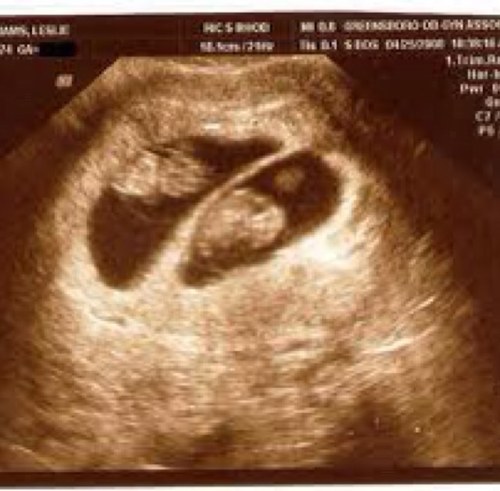 BabyGirlBlack1's profile picture. Unborn