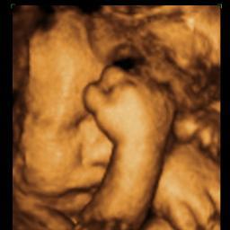 HelloBaby3D's profile picture. Latest high-res 3D ultrasound pictures of your baby. DVD recording of session, CD of still images, and Hello Baby bear with your baby's heartbeat are available!