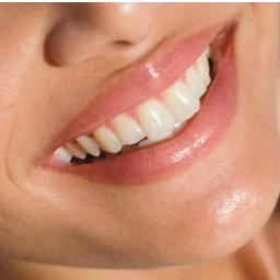 32 Sparkles Dental Clinic
Shop No. 3, Jayshree Sadan,
Old Nagardas Road,
Andheri East