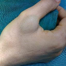 Learner and educator in hand surgery, learning and life