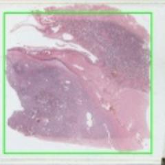 The Juan Rosai collection of historical slide seminars in surgical pathology (this account is not affiliated with the USCAP or Aperio)
