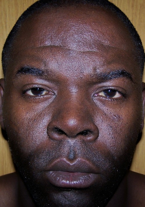 GERRY Profile