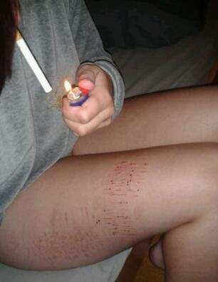 I'm a 16y old girl, full of scars. #staystrong