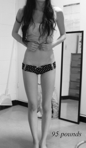 My sadness if neither beautiful nor poetic - bulimic, 5 years -recovering from selfharm. Last cut: sept 2012