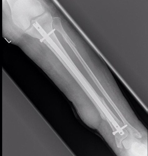 Nottingham university orthopadic teaching Book your sessions or request topics We like bones and if there is a fracture we can fix it!
