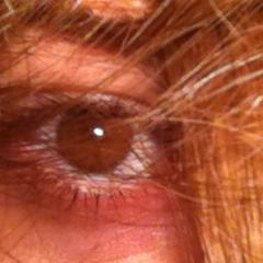 trichotillomania, self harm, deppresion, forever feeling like I dont belong ~ I follow back3
