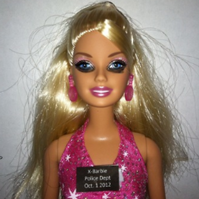 Pictures bad barbie CoolSculpting Gone