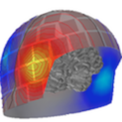 MNE : Magnetoencephalography (MEG) and Electroencephalography (EEG) in Python