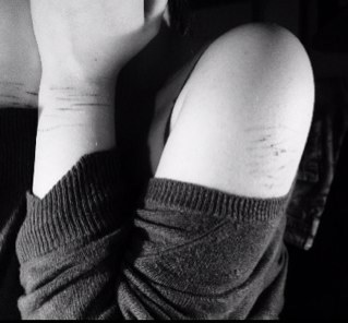 Depression like hell. // Ask something? - http://t.co/ZuZu6B8C