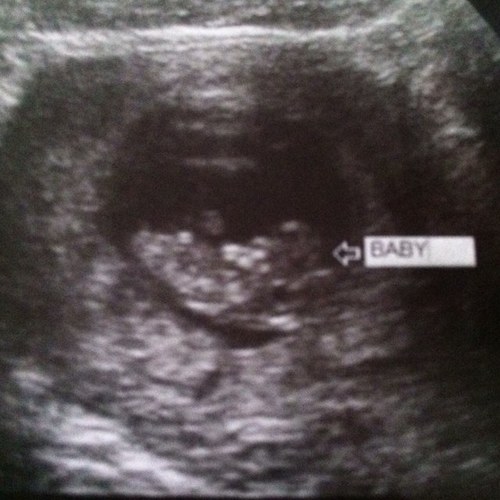 18. Engaged: John Bearden❤ Pregnant