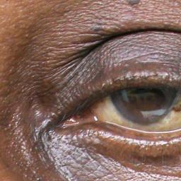 CONSULTANT EYE SPECIALIST.M.B,CH.B MMED (OPH) FEACO
INTERNATIONAL MEMBER OF AMERICAN ACADEMY OF OPHTHALMOGLY.WINNER OF INTERNATIONAL OPHTHALMOLOGIST AWARD 2010