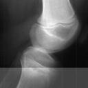 Robert Griffith - @blountsdisease - Twitter