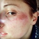 Rachel Ranson - @RachelRansprobs - Twitter