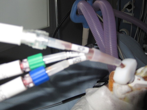 Everything about neurocritical care