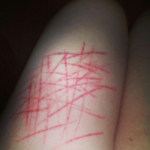 I feel fat and ugly all the time.. I cut and it dosnt get better :/