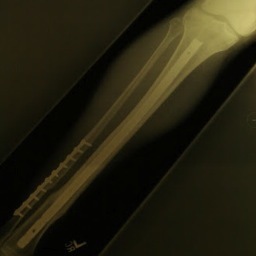 legrecovery's profile picture. Love to run, bike and play sports. I've been tracking my physical recovery from a broken leg since 2006