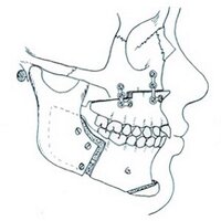 Oral & Maxillofacial (@omfs1) 's Twitter Profile