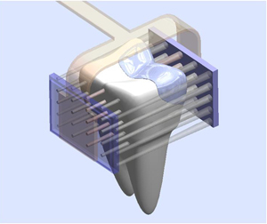 Ultrasound will soon be a viable diagnostic imaging tool for dentistry.  Follow for info on how to be among the 1st dentists to bring this innovation to market!