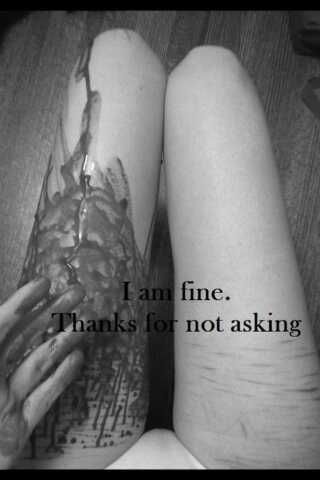 Addicted to cutting| 16 | female| SH.