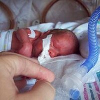 Preterm Research(@PretermResearch) 's Twitter Profile Photo