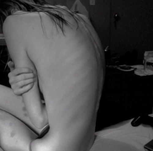 Una maldita y horrenda gorda, depresiva, bisexual pensando seriamente ser lesbiana mente suicida, odiando todo pero mas a mi misma, P.A: 52 . Meta: 45