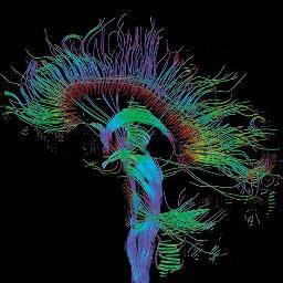 Neuroscience Research Driven Students is a club at Western Washington University. We welcome all backgrounds of students who share a common love neuroscience.