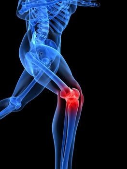 For those with dodgy knees; feel free to talk about your ACL problems, tips or to help those on their return to sport. Thanks and welcome.