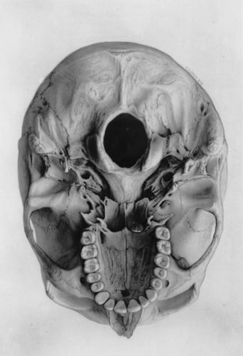 (sic) Observadora de apoptosis, radicales libres y especies reactivas de todas las dimensiones (sic)