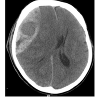 neurotrauma (@neuro_trauma) 's Twitter Profile
