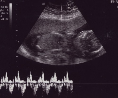 Freeloader3's profile picture. I don't have much info... I'll have to get back to you once I figure things out.