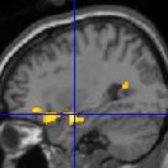 Associate Professor, Psychology | Brain Imaging & Memory lab | Toronto Metropolitan University