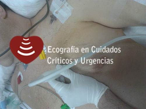 Ecografía en Cuidados Críticos y Urgencias