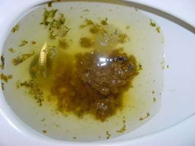 The World Eats Poop. http://t.co/Gj0zS5nl5e