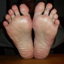 In my opinion feet are the sexiest part of human being :-).
https://t.co/ScGU3GPKT3 or contact me on skype with feetallergie1