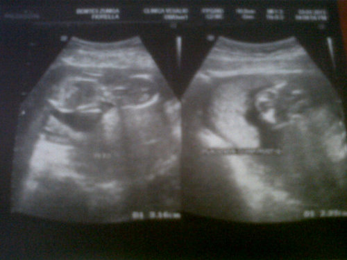 fioruccibz's profile picture. Vivo mis días como si fueran los últimos días de mi vida !!