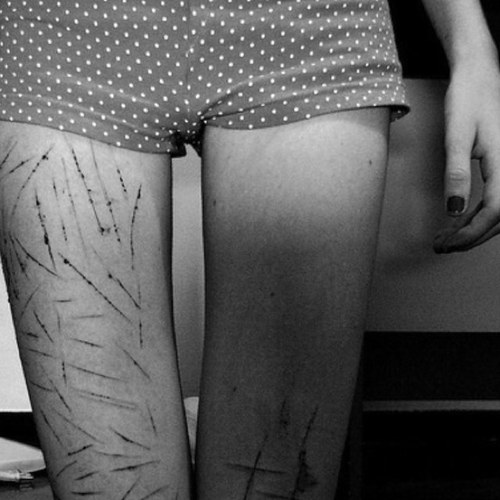~depression took over.~ I wish I was enough. {UGW: 85lbs.} ||Fat Failure.|| Trying to recover.