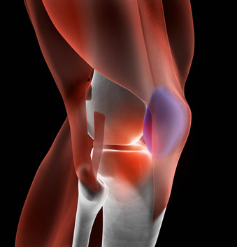 I am certified fitness instructor, specialized in knee exercises...
http://t.co/kKCklT47z7