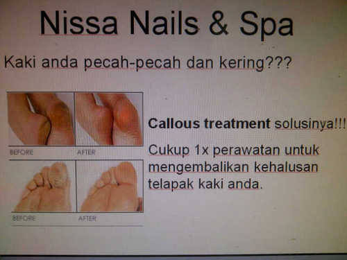 Menagani kuku cantengan, kaki kapalan, dan menicure, pedicure, nail polish, dan nail art.. Pin BB:26A56100