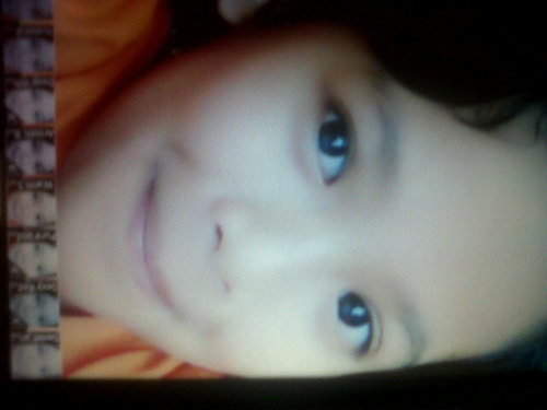 SDBPI YES!☺ • 10years • 5B☀ • Botox B-) • ♥______!