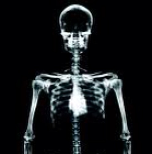Radiology IT; IM&T, NHS, healthcare, informatics, interfaces, RIS, PACS, HL7, VR, SQL, Crystal Reports, Tableau ...and a whole lot more!