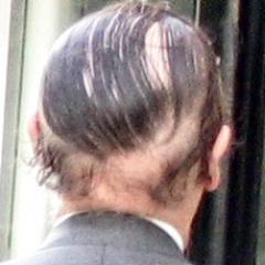 MinoxiBoost's profile picture. A natural and pharmaceutical blended formula that takes Minoxidil to an ENTIRELY new level of HAIR STABILITY and RE-GROWTH for BOTH MEN AND WOMEN!