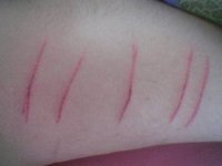 icutmyselff's profile picture. Lost teen. Do you really care though?