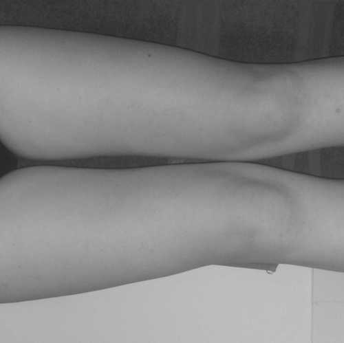 self harm, depression, anxiety. mia is my best friend.