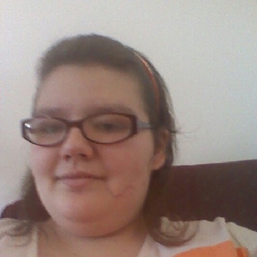 Hey it's Kaity. My right leg is amputated and I still can walk. Getting my Prosthetic! Never ever give up. 3