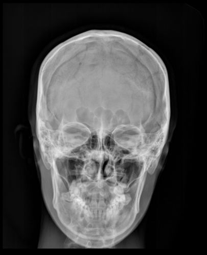 Chiropractic Digital X-Ray Upgrades, Full DR Room Replacements, Project planning, Cloud Based PACS services