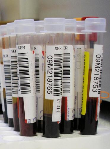 Sample Collection all Labs & Diagnostic Centres Like Dr. Lal Path ,  Ranbaxy, Also Provides Door Step Service  Sample Collection & Report all over Gurgaon.