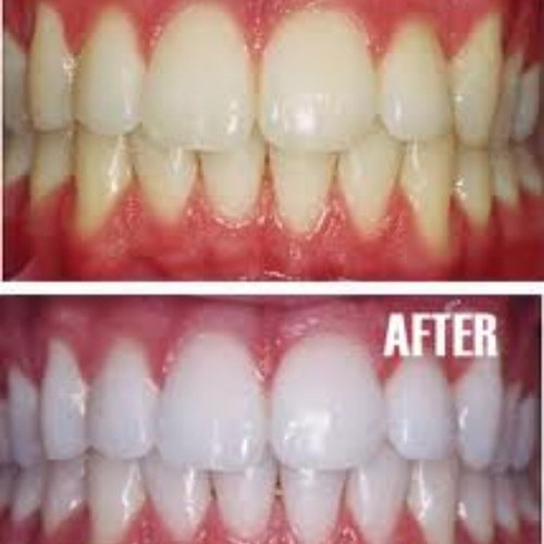 LEDteeth_beauty Profile Picture