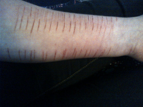 Grace. 14. Canada. Suicide attempts: 2. Avi is me. Feet together; thighs apart.
