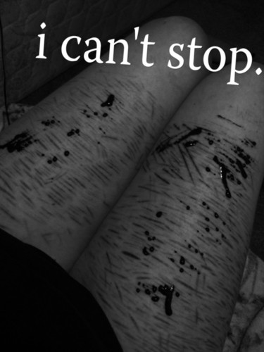 selfharm___'s profile picture. Just another ugly girl - Selfharm - Selfhate - Eating disorder -