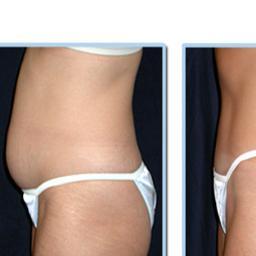 Using Lasers to make you look and feel great